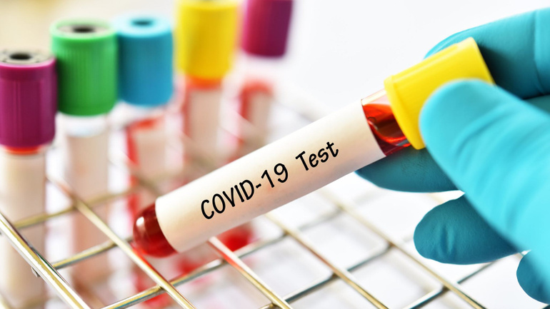 covid test.jpg