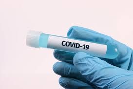 test covid.jpg