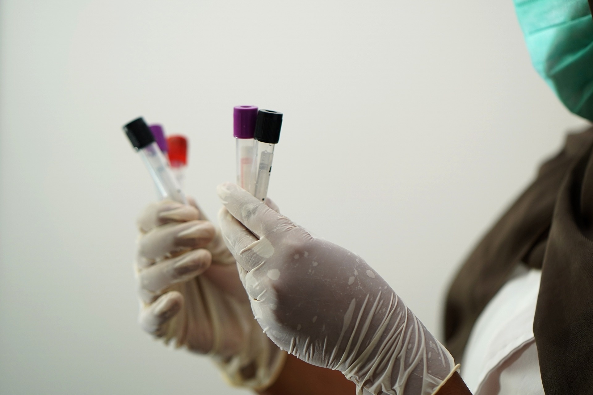 laboratory-g8bc90b31a_1920.jpg