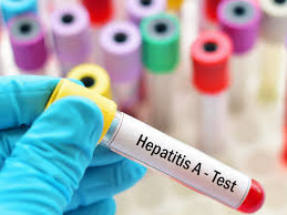 hepatitída A.jpg